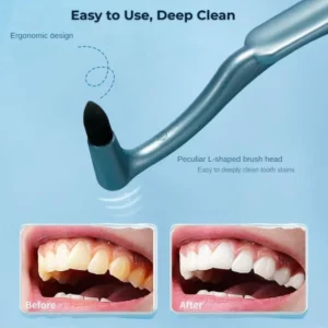 মাত্র ৩ দিনেই দাঁতের দাগ কমতে শুরু! UltraClean Tooth Stain Remover (3Pcs)